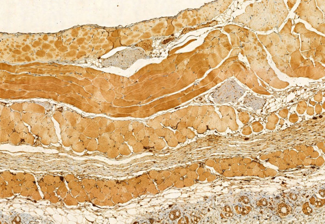 SKAP2 Antibody in Immunohistochemistry (Paraffin) (IHC (P))