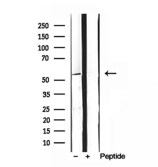 SKAP2 Antibody in Western Blot (WB)