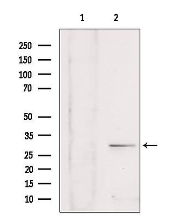 SULT4A1 Antibody in Western Blot (WB)