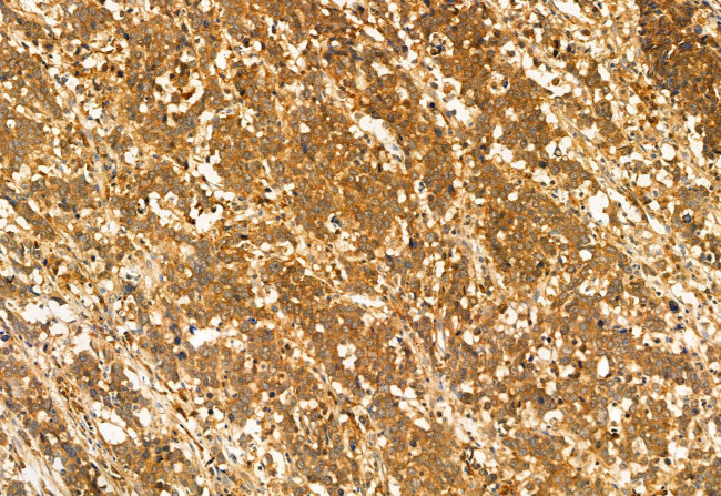 AdoHcyase 2 Antibody in Immunohistochemistry (Paraffin) (IHC (P))