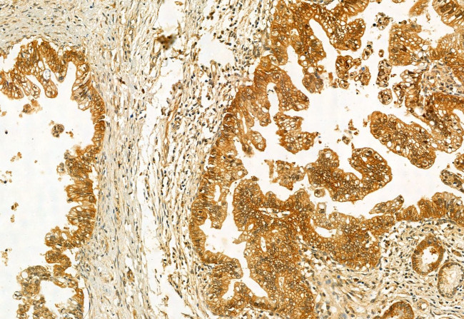 AdoHcyase 2 Antibody in Immunohistochemistry (Paraffin) (IHC (P))