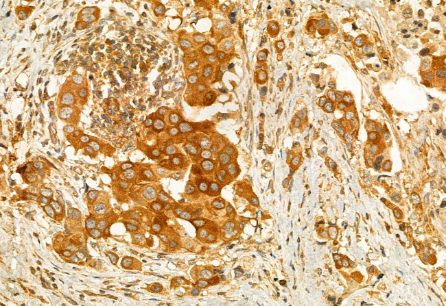 AdoHcyase 2 Antibody in Immunohistochemistry (Paraffin) (IHC (P))