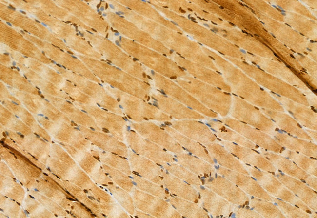 BBS2 Antibody in Immunohistochemistry (Paraffin) (IHC (P))