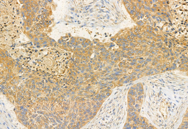 BBS2 Antibody in Immunohistochemistry (Paraffin) (IHC (P))