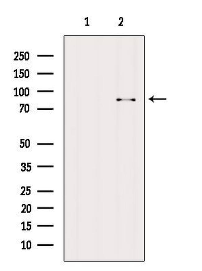 BBS2 Antibody in Western Blot (WB)