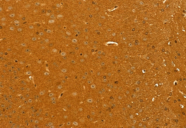 GOLPH3 Antibody in Immunohistochemistry (Paraffin) (IHC (P))