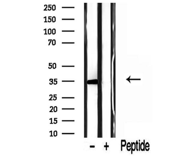 GOLPH3 Antibody in Western Blot (WB)