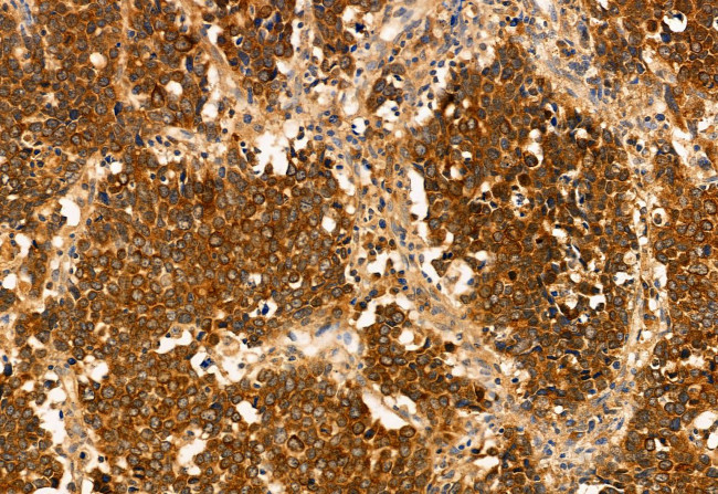 HMGCS1 Antibody in Immunohistochemistry (Paraffin) (IHC (P))