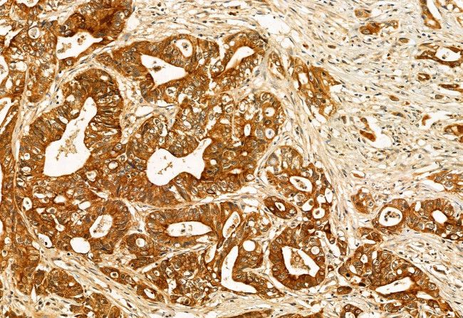 HMGCS1 Antibody in Immunohistochemistry (Paraffin) (IHC (P))