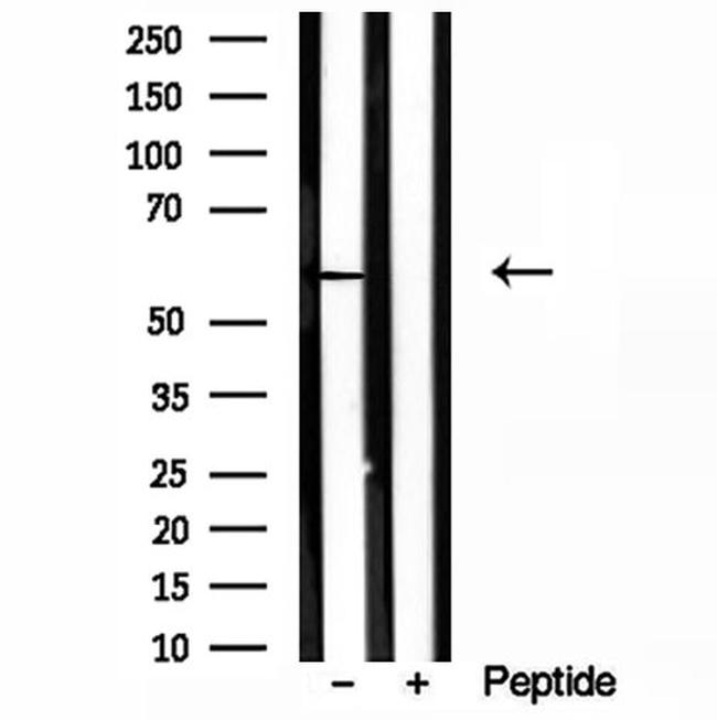 HMGCS1 Antibody in Western Blot (WB)