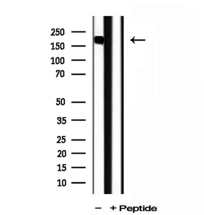 PPFIA1 Antibody in Western Blot (WB)