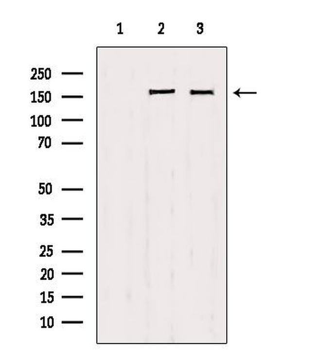 PPFIA1 Antibody in Western Blot (WB)