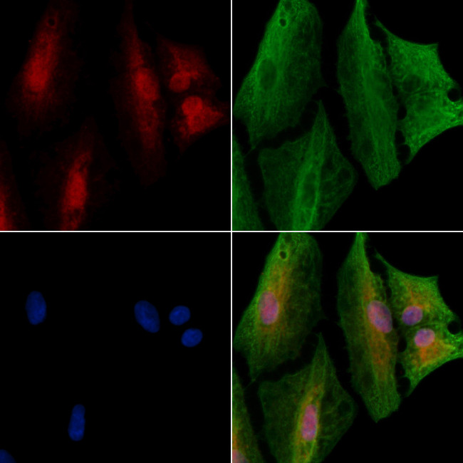 SPOP Antibody in Immunocytochemistry (ICC/IF)