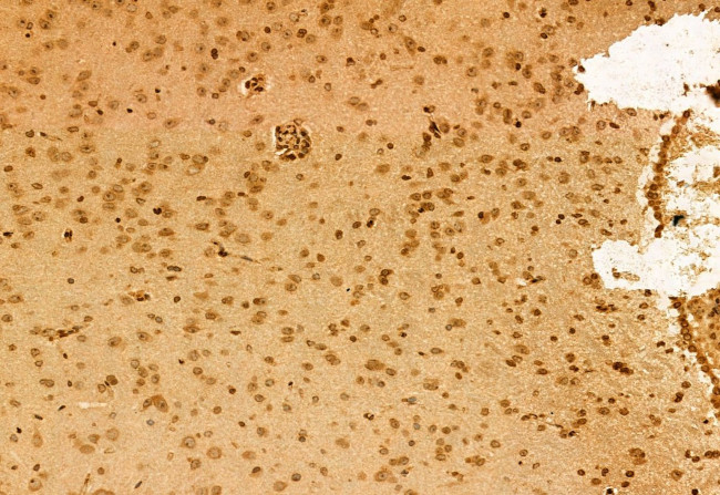 SPOP Antibody in Immunohistochemistry (Paraffin) (IHC (P))