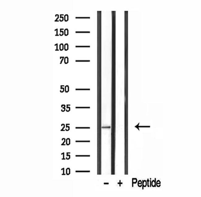 GFER Antibody in Western Blot (WB)