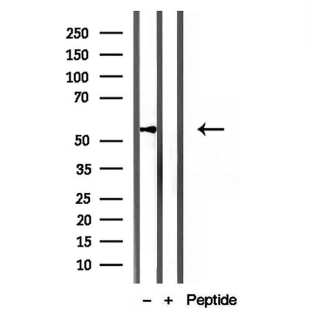 KMO Antibody in Western Blot (WB)