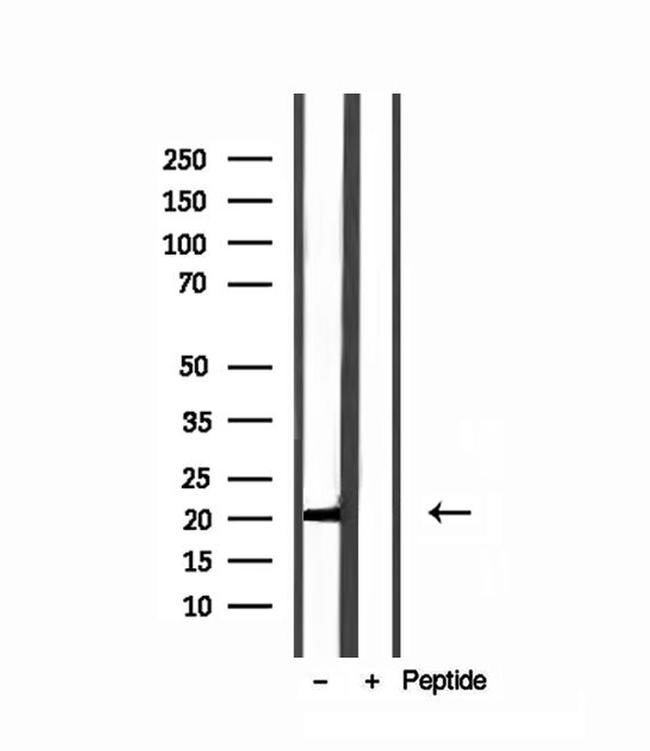 MPV17 Antibody in Western Blot (WB)