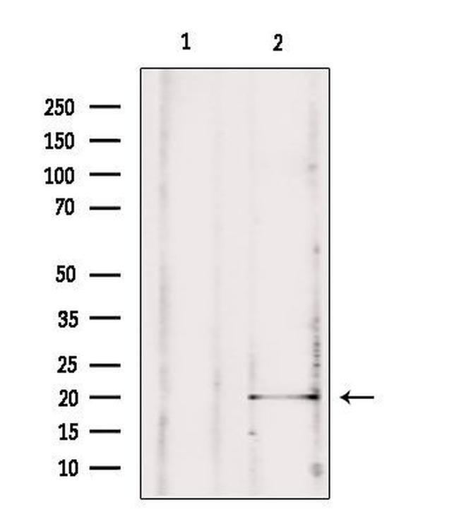 MPV17 Antibody in Western Blot (WB)