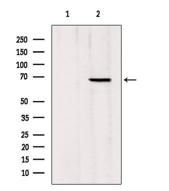 MTA3 Antibody in Western Blot (WB)