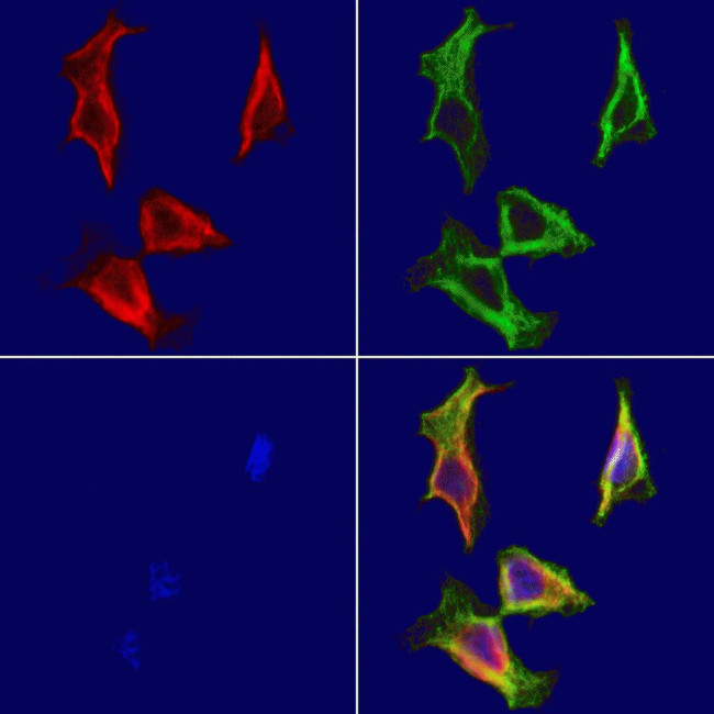 MYH7 Antibody in Immunocytochemistry (ICC/IF)