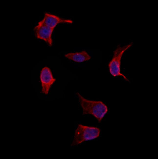 MYH7 Antibody in Immunocytochemistry (ICC/IF)