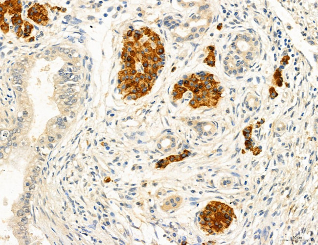 MYH7 Antibody in Immunohistochemistry (Paraffin) (IHC (P))