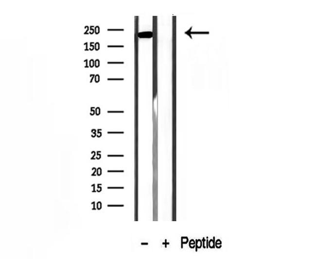 MYH7 Antibody in Western Blot (WB)