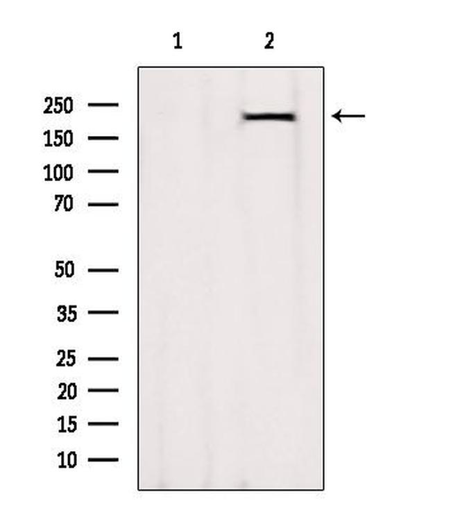 MYH7 Antibody in Western Blot (WB)