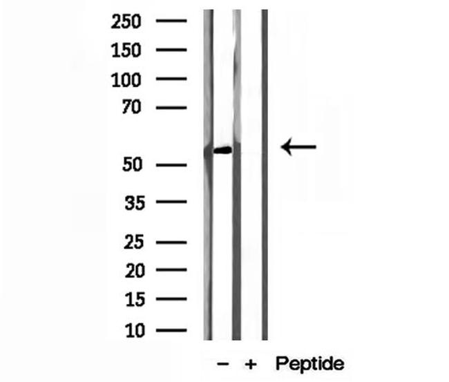 NEU4 Antibody in Western Blot (WB)