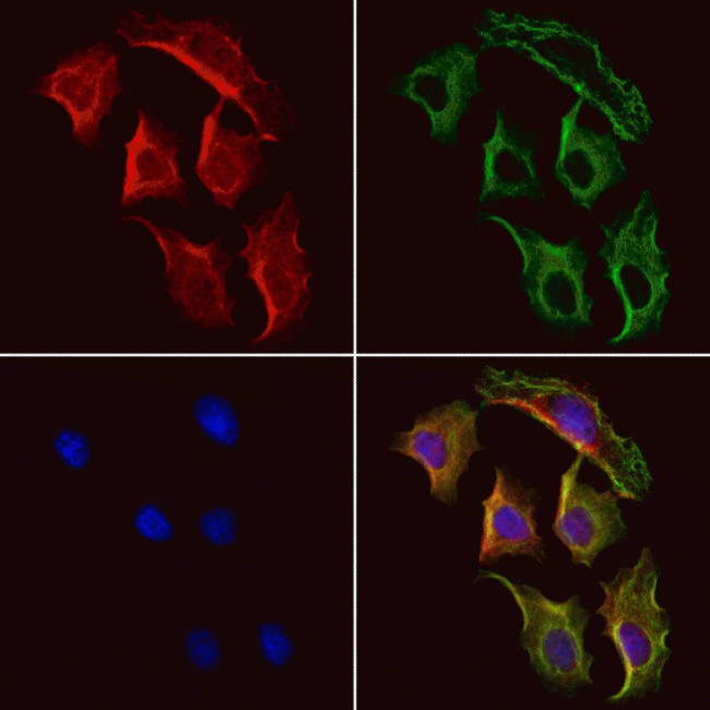 PSAT1 Antibody in Immunocytochemistry (ICC/IF)