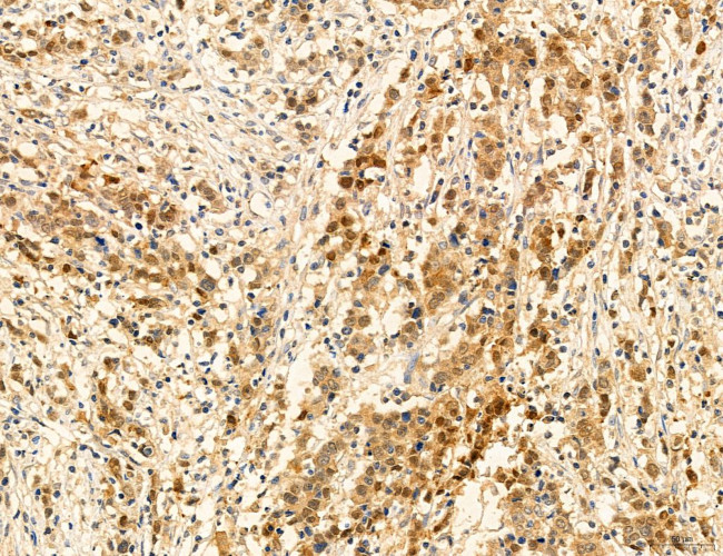 PSAT1 Antibody in Immunohistochemistry (Paraffin) (IHC (P))