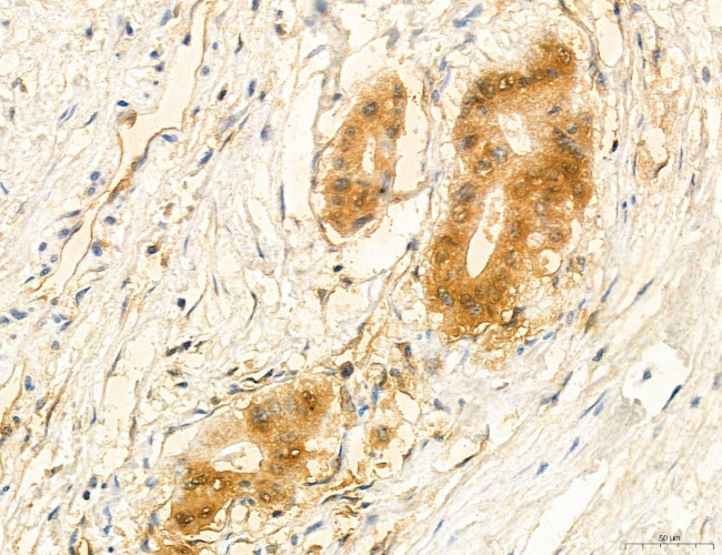 PSAT1 Antibody in Immunohistochemistry (Paraffin) (IHC (P))