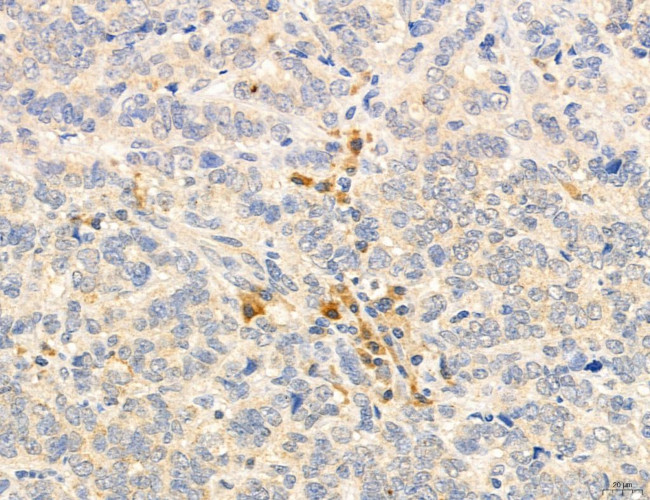 PSAT1 Antibody in Immunohistochemistry (Paraffin) (IHC (P))