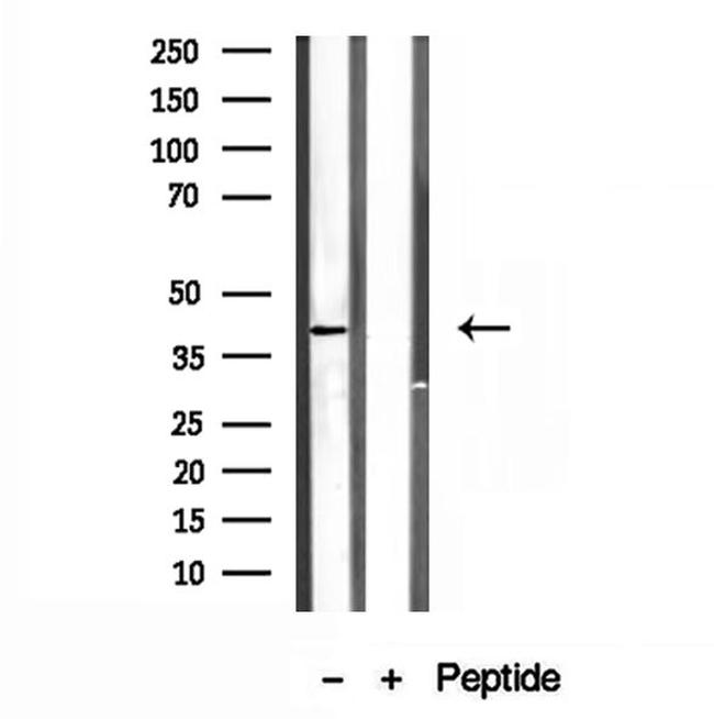 PSAT1 Antibody in Western Blot (WB)