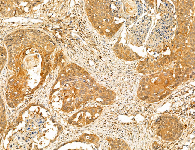 PYGL Antibody in Immunohistochemistry (Paraffin) (IHC (P))