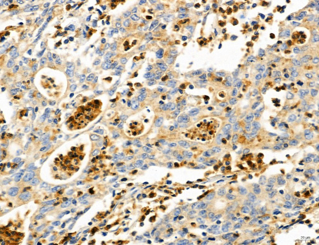 PYGL Antibody in Immunohistochemistry (Paraffin) (IHC (P))