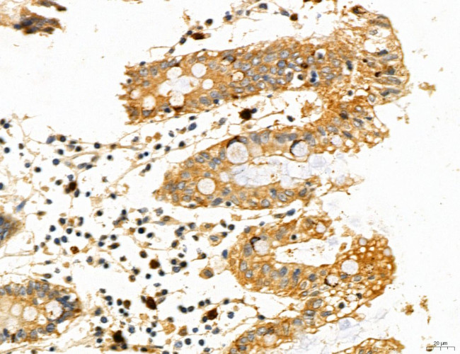 PYGL Antibody in Immunohistochemistry (Paraffin) (IHC (P))