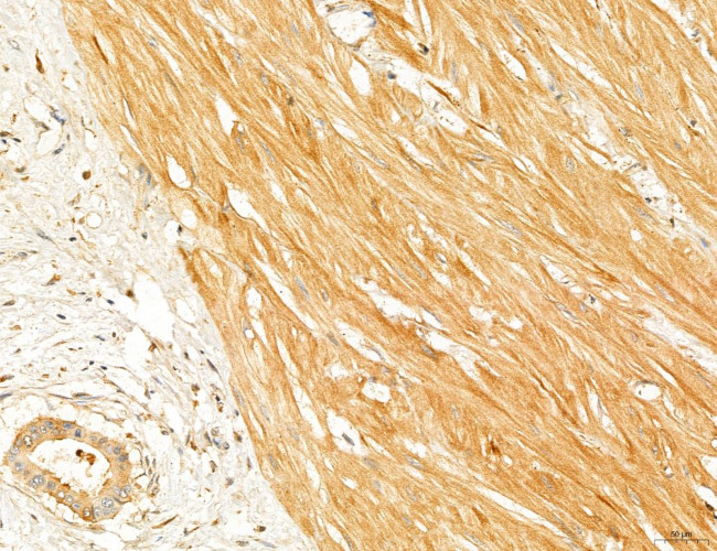 PYGL Antibody in Immunohistochemistry (Paraffin) (IHC (P))