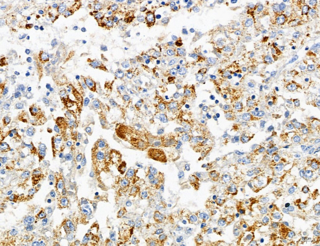 PYGL Antibody in Immunohistochemistry (Paraffin) (IHC (P))