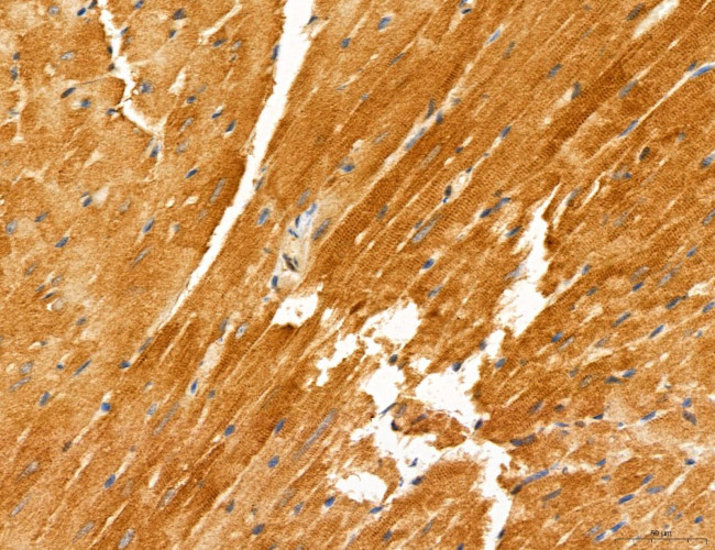 PYGL Antibody in Immunohistochemistry (Paraffin) (IHC (P))