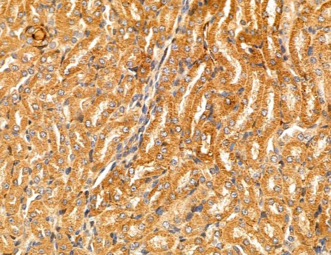 PYGL Antibody in Immunohistochemistry (Paraffin) (IHC (P))