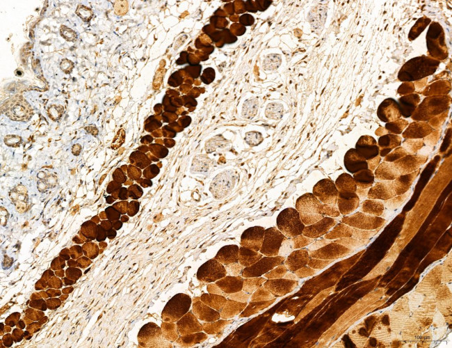 PYGL Antibody in Immunohistochemistry (Paraffin) (IHC (P))