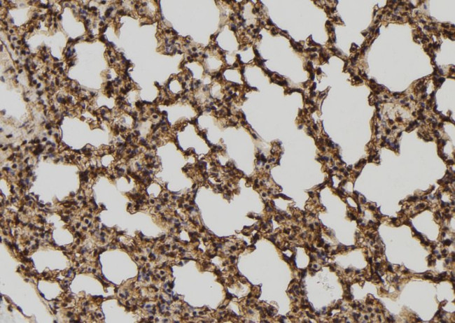 TELO2 Antibody in Immunohistochemistry (Paraffin) (IHC (P))