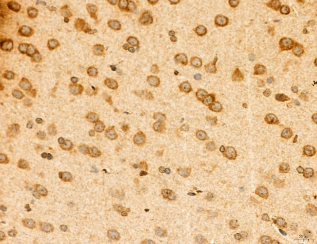 TELO2 Antibody in Immunohistochemistry (Paraffin) (IHC (P))