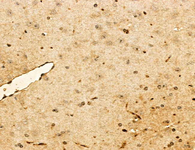 TELO2 Antibody in Immunohistochemistry (Paraffin) (IHC (P))