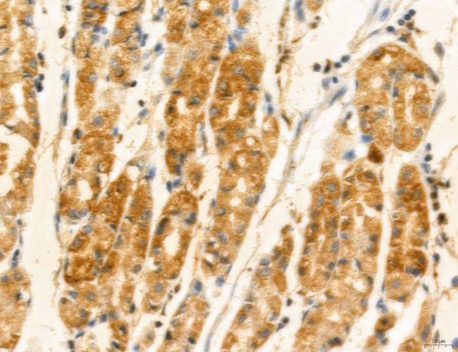 TELO2 Antibody in Immunohistochemistry (Paraffin) (IHC (P))