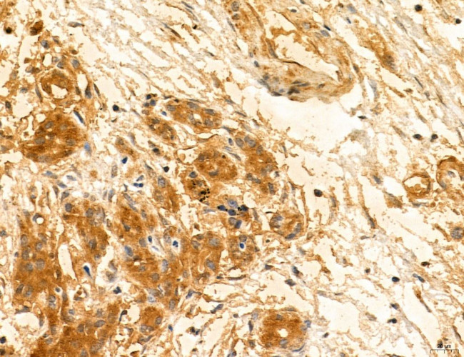 TELO2 Antibody in Immunohistochemistry (Paraffin) (IHC (P))