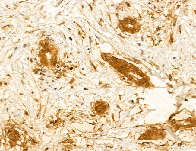 TELO2 Antibody in Immunohistochemistry (Paraffin) (IHC (P))