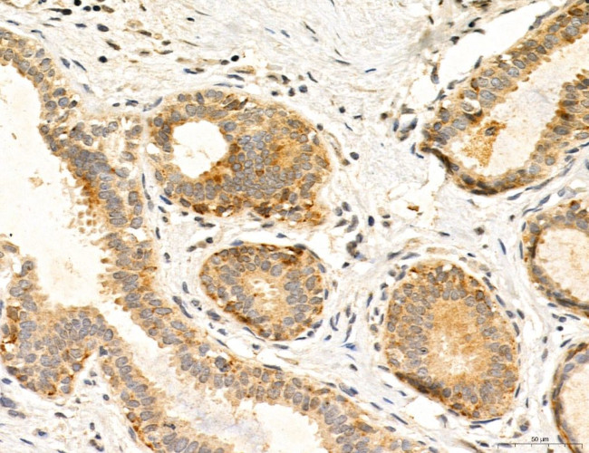 TELO2 Antibody in Immunohistochemistry (Paraffin) (IHC (P))