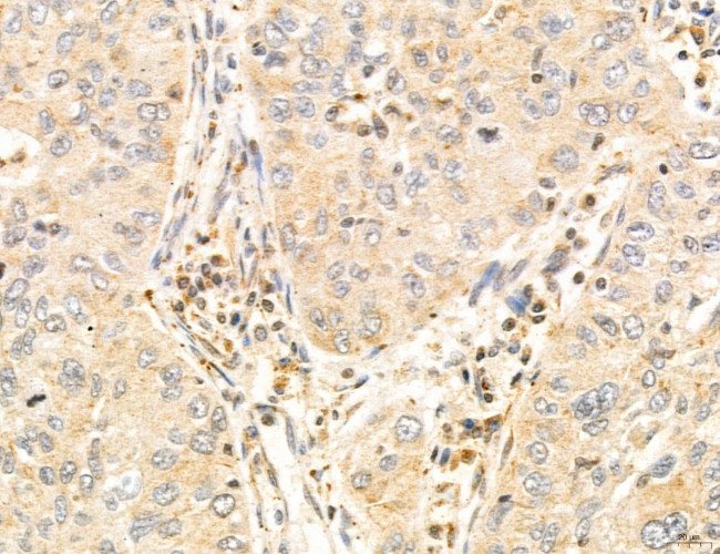 TELO2 Antibody in Immunohistochemistry (Paraffin) (IHC (P))